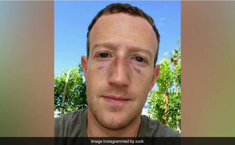 馬克&middot;扎克伯格被教練打得鼻青臉腫