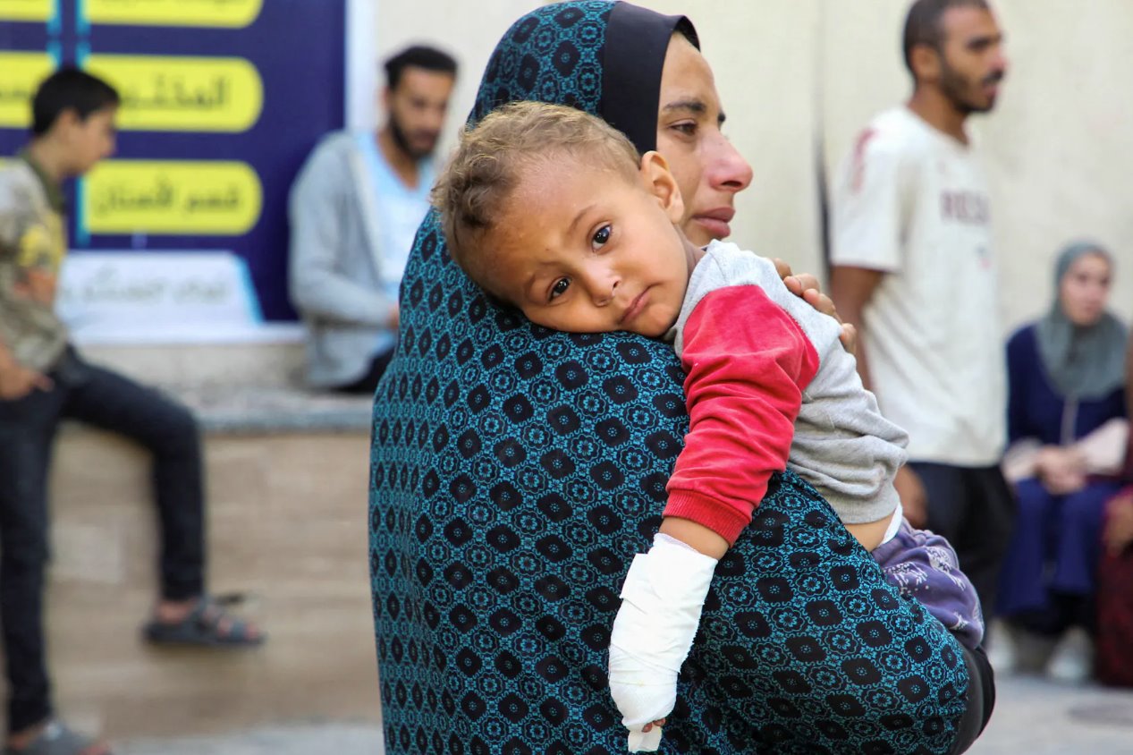 2024年5月10日,在加沙地帶南部的拉法,一名受傷的巴勒斯坦兒童.