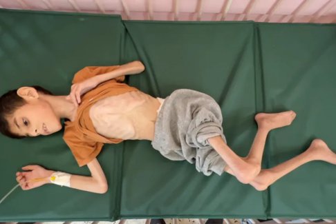 加沙供水系統(tǒng)破損導(dǎo)致兒童患病