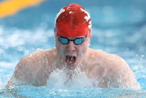 游泳運動員古德本被診斷出患有無法手術的腦腫瘤